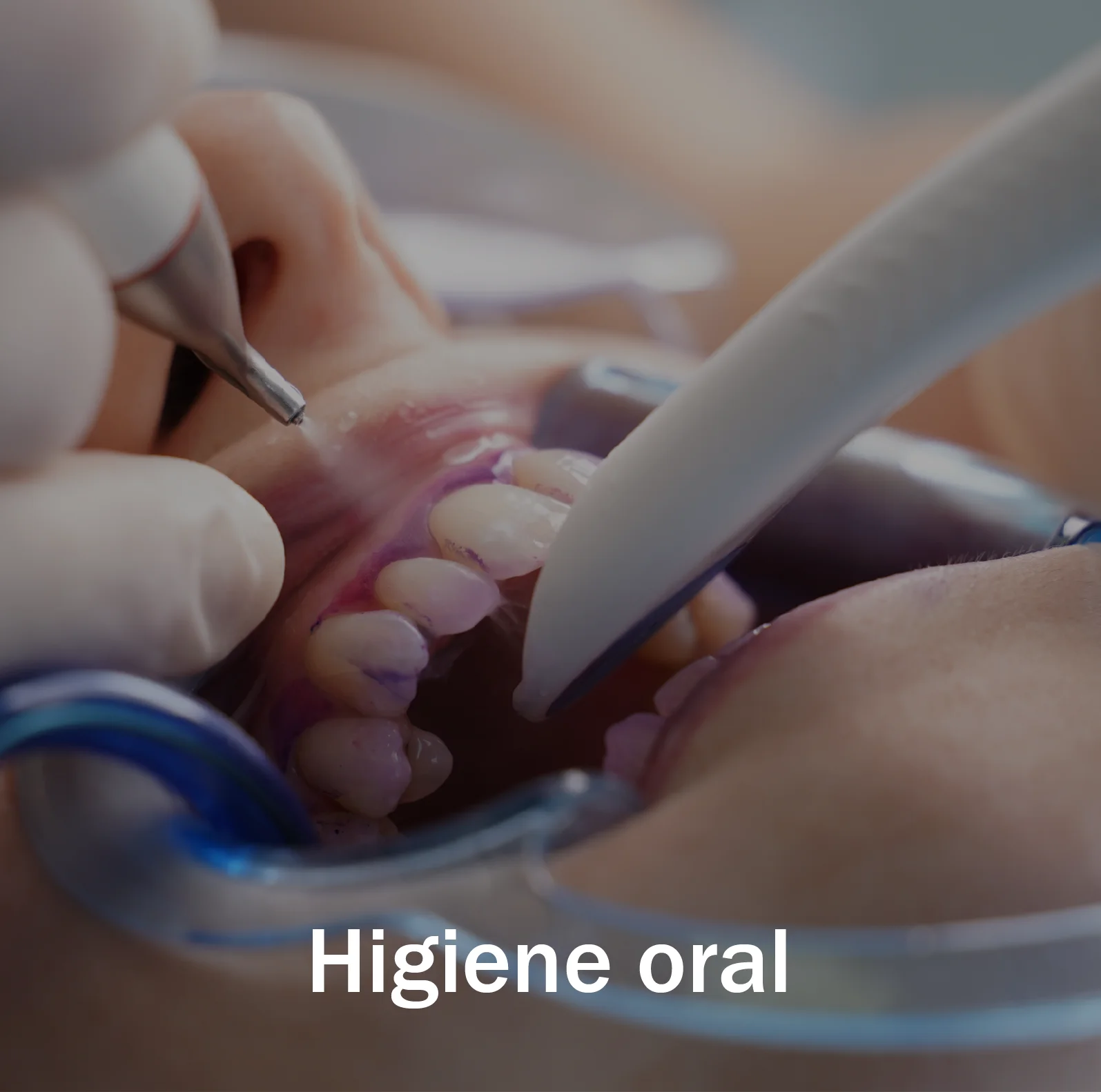 Serviço Clínica OralPlan - Higiene Oral