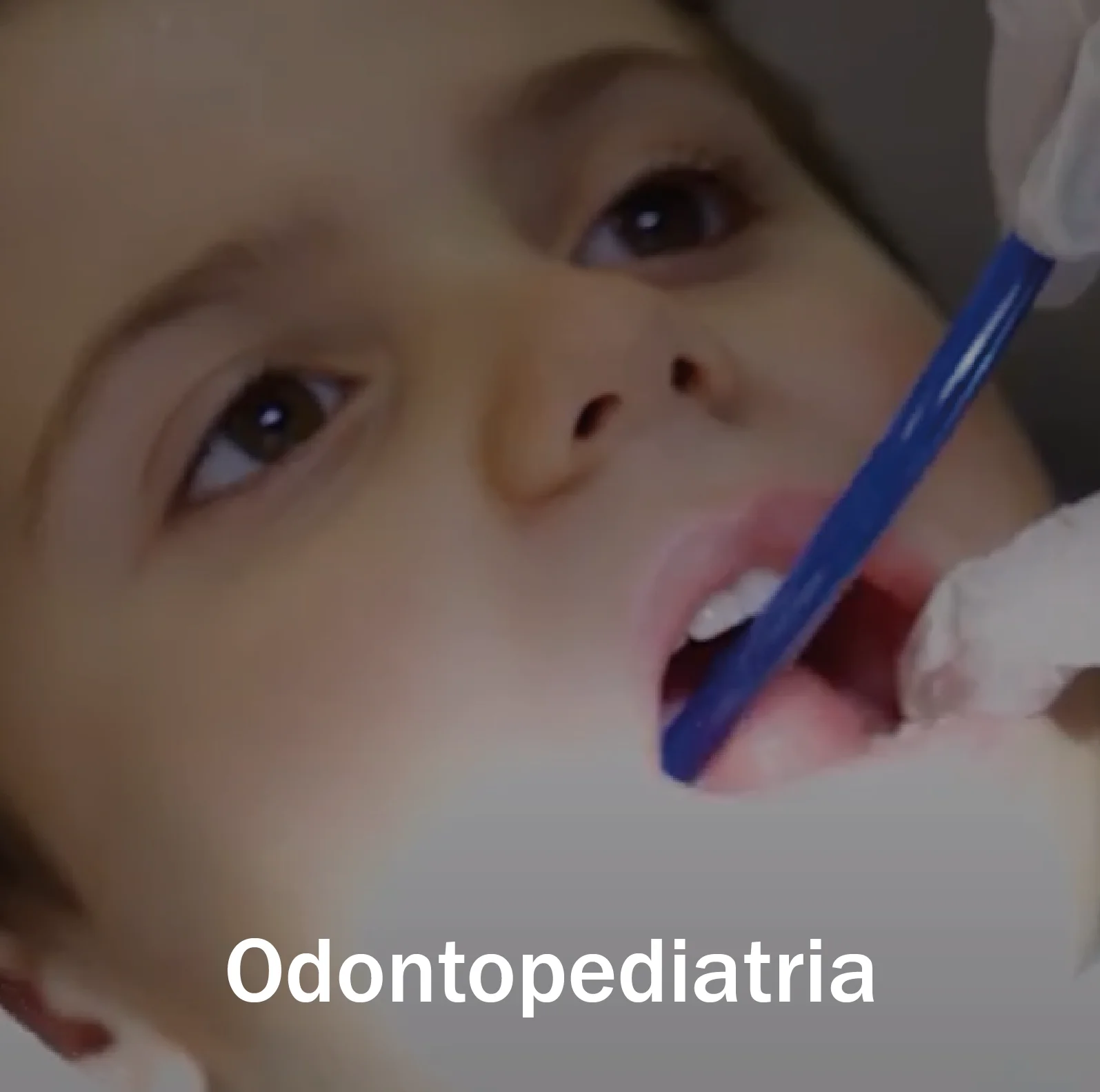 Serviço Clínica OralPlan - Odontopediatria