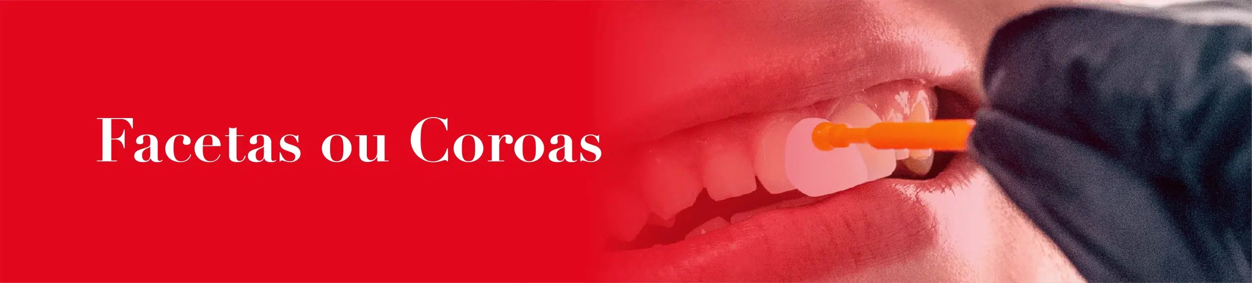 banner-facetas-mobile Facetas Dentárias OralPlan