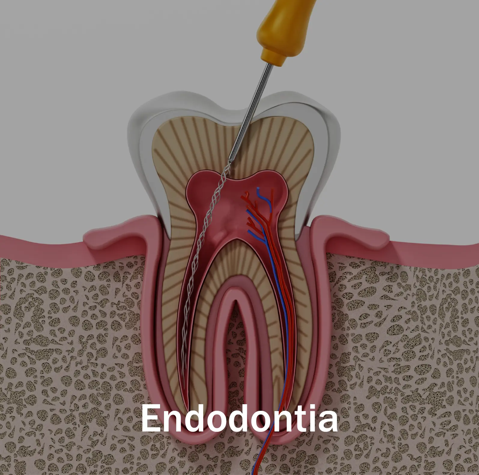 Serviço Clínica OralPlan - Endodontia