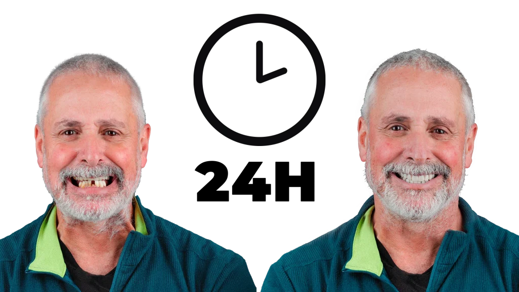 Prótese Fixa em 24h OralPlan