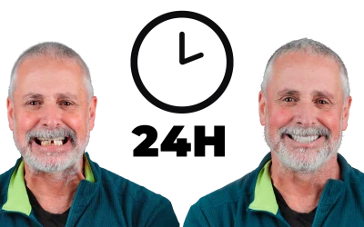 Colocação de Prótese Fixa em 24h