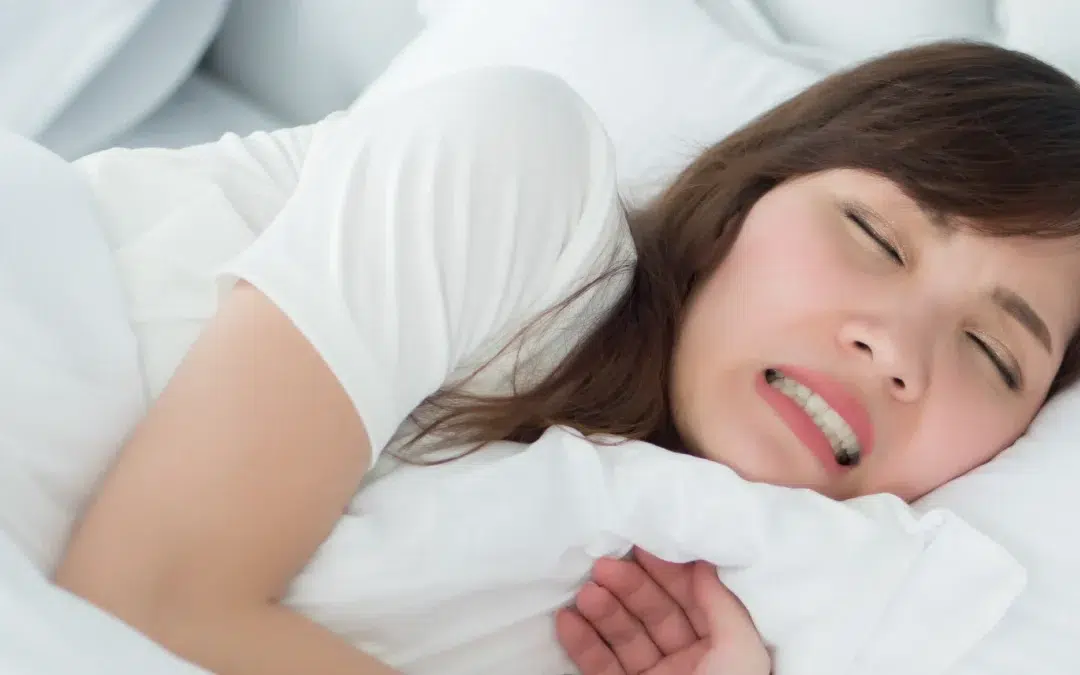 Como tratar Bruxismo?