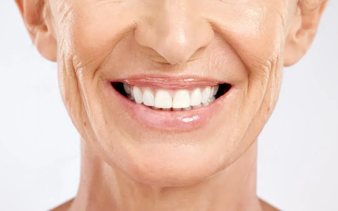 Facetas Dentárias: o segredo por trás dos sorrisos perfeitos!