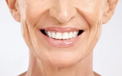 Facetas Dentárias: o segredo por trás dos sorrisos perfeitos!