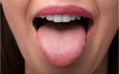 Saiba como cuidar da sua língua