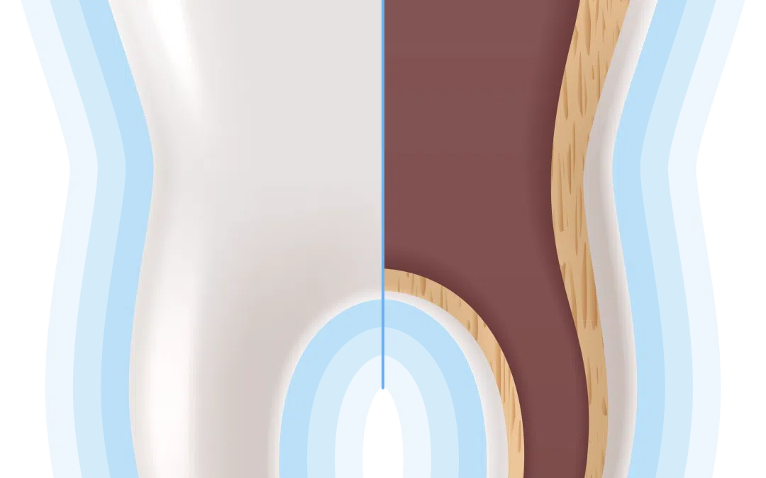 Saúde Oral: como são constituídos os dentes?