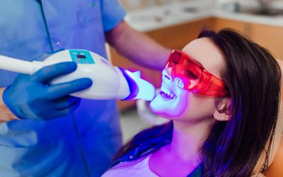 Branqueamento Dentário: conhece todos os diferentes tipos?