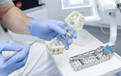 Erros mais comuns nos cuidados pós-cirurgia de implantes dentários e como evitá-los