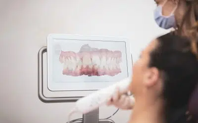 Etapas de um implante dentário com planeamento digital